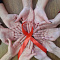 1 декабря 2022 года - Всемирный день борьбы со СПИДом
